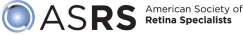 ASRS
